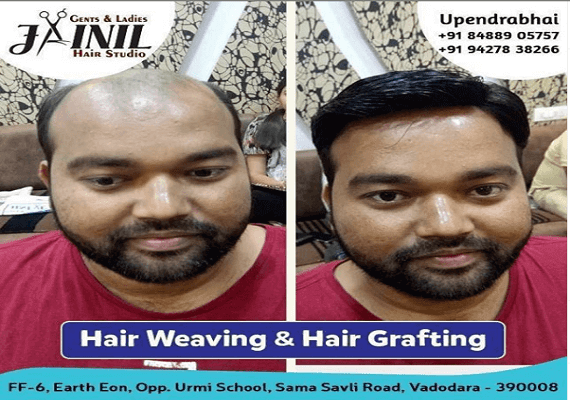 Hair Wig Before After Picture