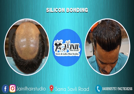 Best Silicon Bonding in Vadodara